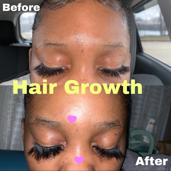 Stimulating Hair Growth Oil - Picture 4 of 5